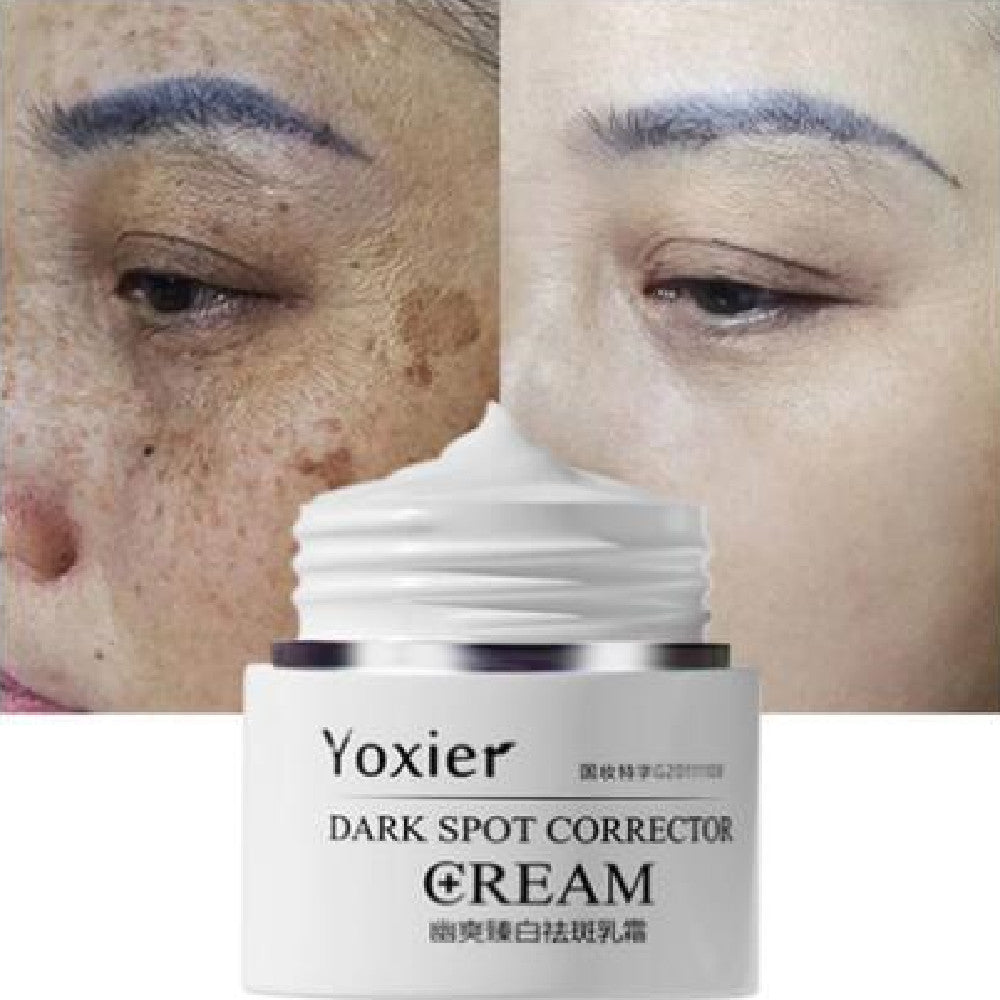 Yoxier Dark Spot Corrector Cream30G