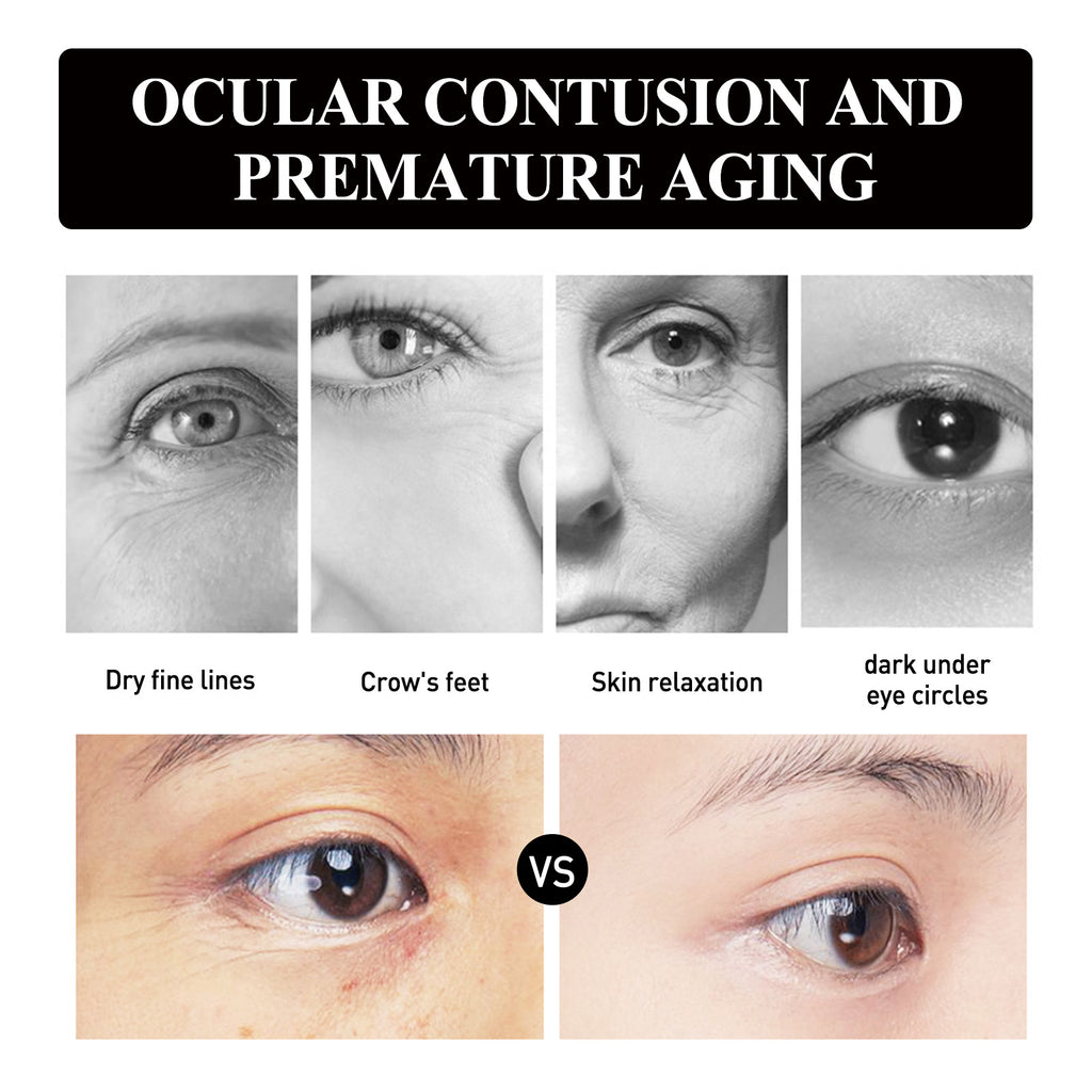 Strawberry Gel Eye Patch – Anti-Aging, Firming & Moisturizing Care