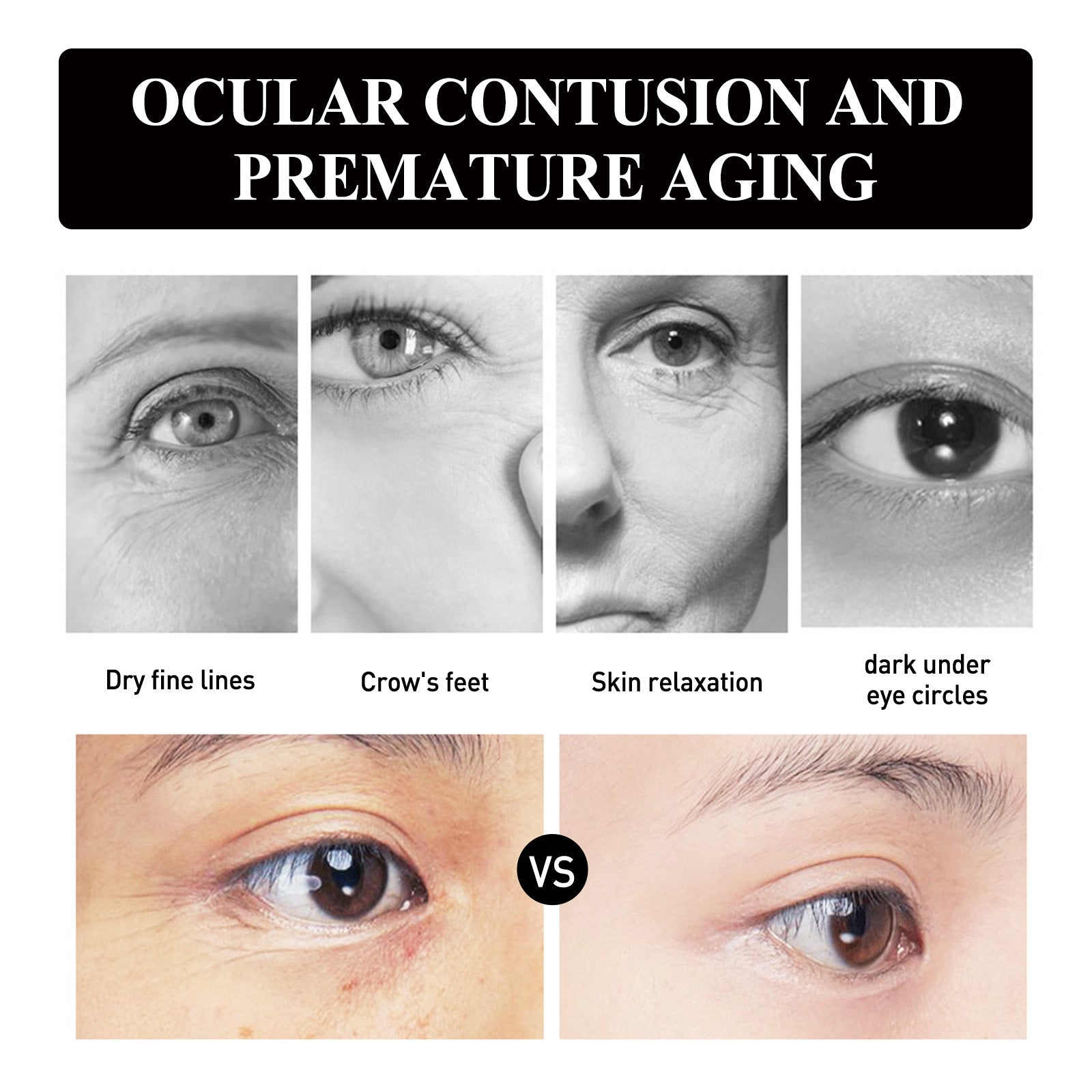 Strawberry Gel Eye Patch – Anti-Aging, Firming & Moisturizing Care